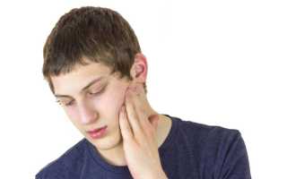 Болит голова скулы зубы