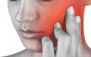 Болит правая часть головы и челюсти