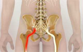 Что болит в самом низу спины