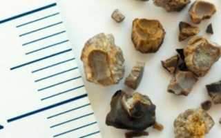 Что может болеть слева внизу спины у женщин