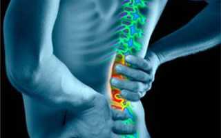 Болят мышцы в паху и отдает в спину