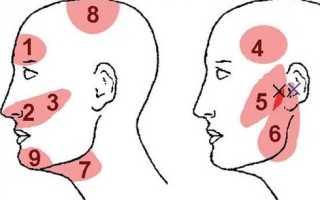 Почему иногда болят виски головы