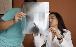 Если болит спина как диагностировать