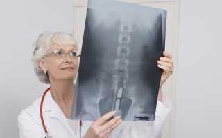 Из за большого живота болит спина