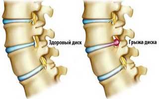 Болит голова рука колит рука