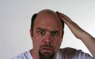 Болит затылок головы и выпадают волосы