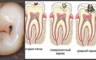 Болит зуб и отдает в висок и голову снять боль