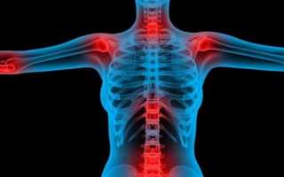 Что значит когда болит спина между лопатками