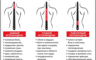 Что за болезнь когда болит спина