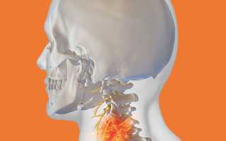 Почему болит шейный отдел позвоночника и голова