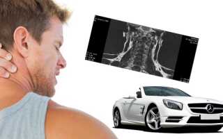 Болит спина после езды на машине