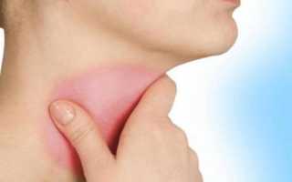 Горло немножко болит и голова