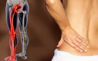Болела спина теперь болит нога правая причина