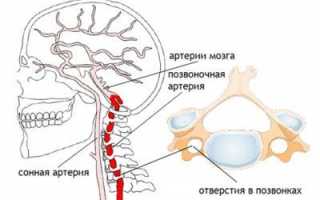 Шейный отдел спина болит может быть от этого головные боли