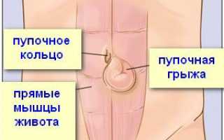 Что может болеть в левом боку на уровне пупка со спины