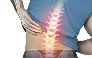 Болит спина если стоять на одном месте