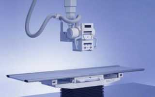 Болит спина где сделать снимки