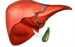 После удаления желчного пузыря болит спина между ребрами
