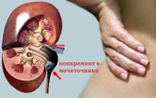 Средняя левая часть спины болит