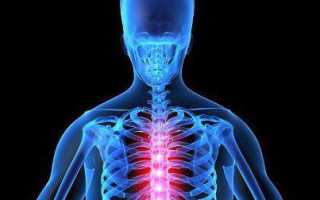 Почему может болеть спина вдоль позвоночника