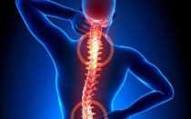 Какие есть таблетки от сильных болей в спине