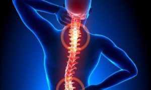 Какие есть таблетки от сильных болей в спине