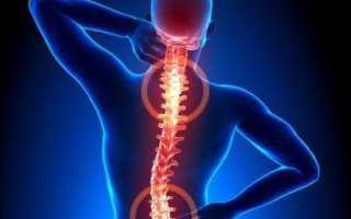 Какие есть таблетки от сильных болей в спине