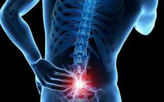 Болит спина и копчик у мужчин