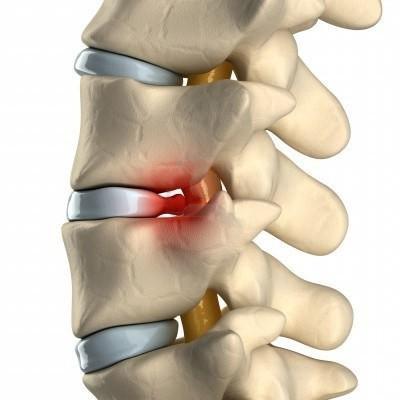 Болят мышцы в паху и отдает в спину