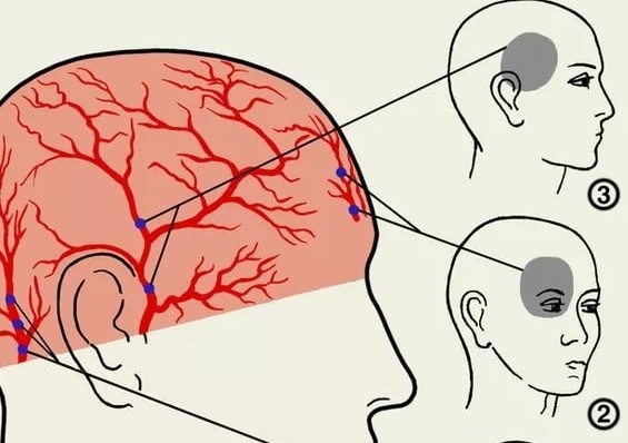 Что делать если у меня болит голова и глаза