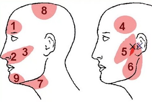Почему иногда болят виски головы