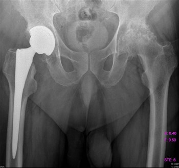 Болят мышцы в паху и отдает в спину