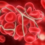 Причины и лечение сгустков крови в матке после родов