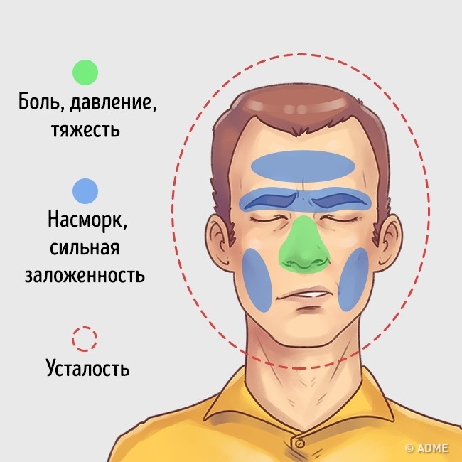 болит ли голова от внчс