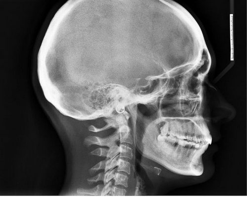 Почему болит голова когда встаешь с дивана