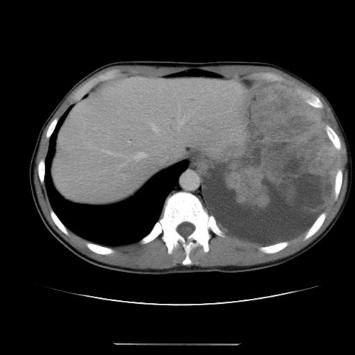 Под ребром на спине уплотнение и болит