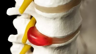 При ходьбе болит спина справа