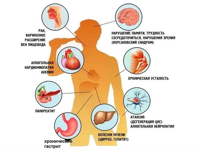 Последствие чрезмерного употребления алкоголя Последствия алкоголизма