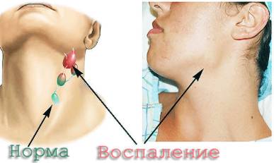 Болят колени и спина температура