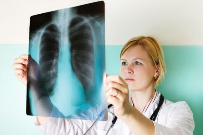 Рентген легких