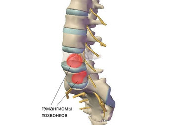 Болит спина если стоять на одном месте
