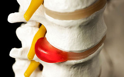 Болят мышцы в паху и отдает в спину