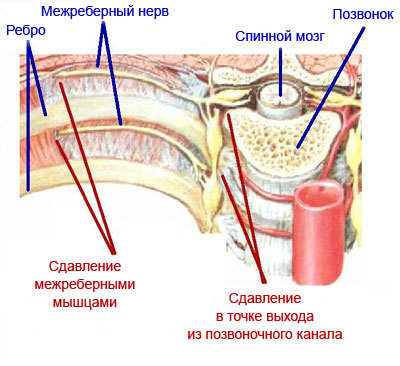 Что болит внизу ребра со спины
