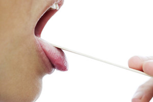 Онемение языка