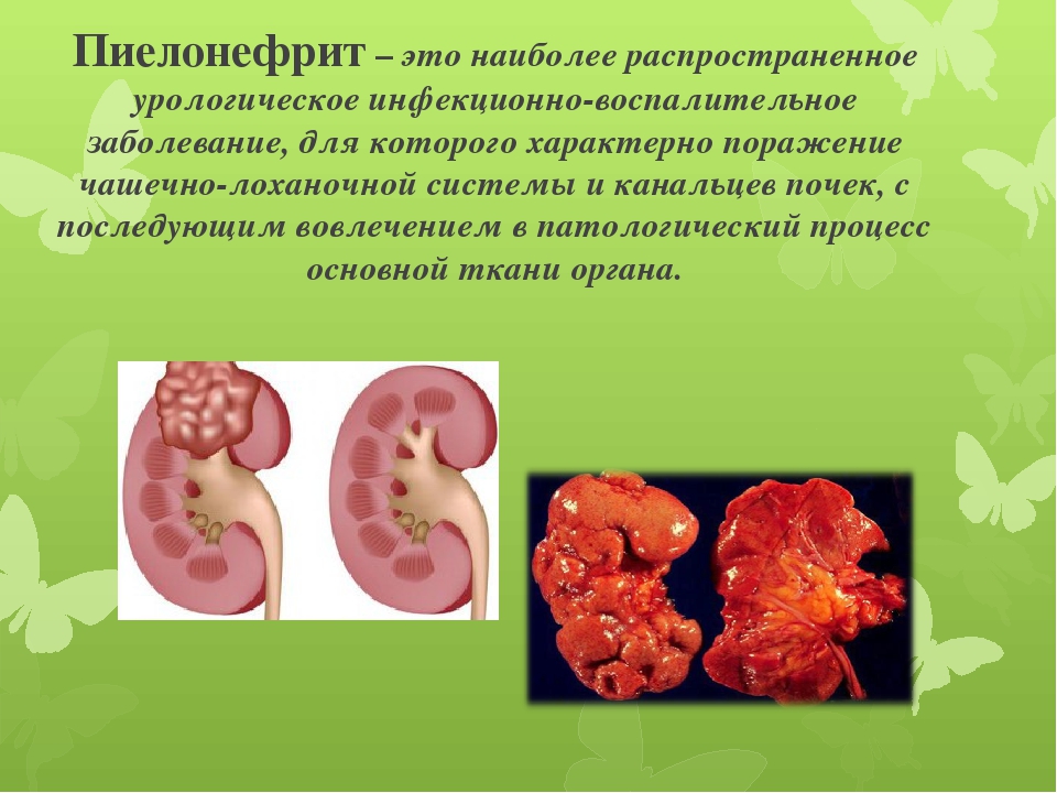 Под ребром на спине уплотнение и болит