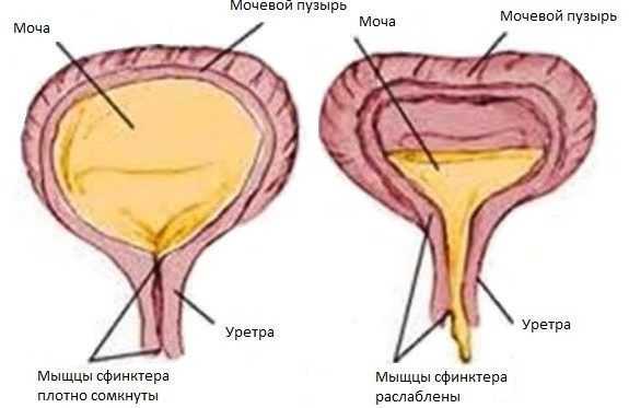 oporozhnenie-mochevogo-puzyrya-e1501099830754.jpg