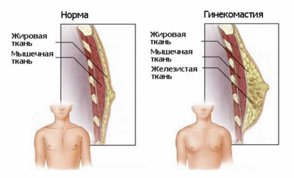 gyno.jpg