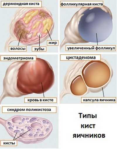 vidy-kist.jpg